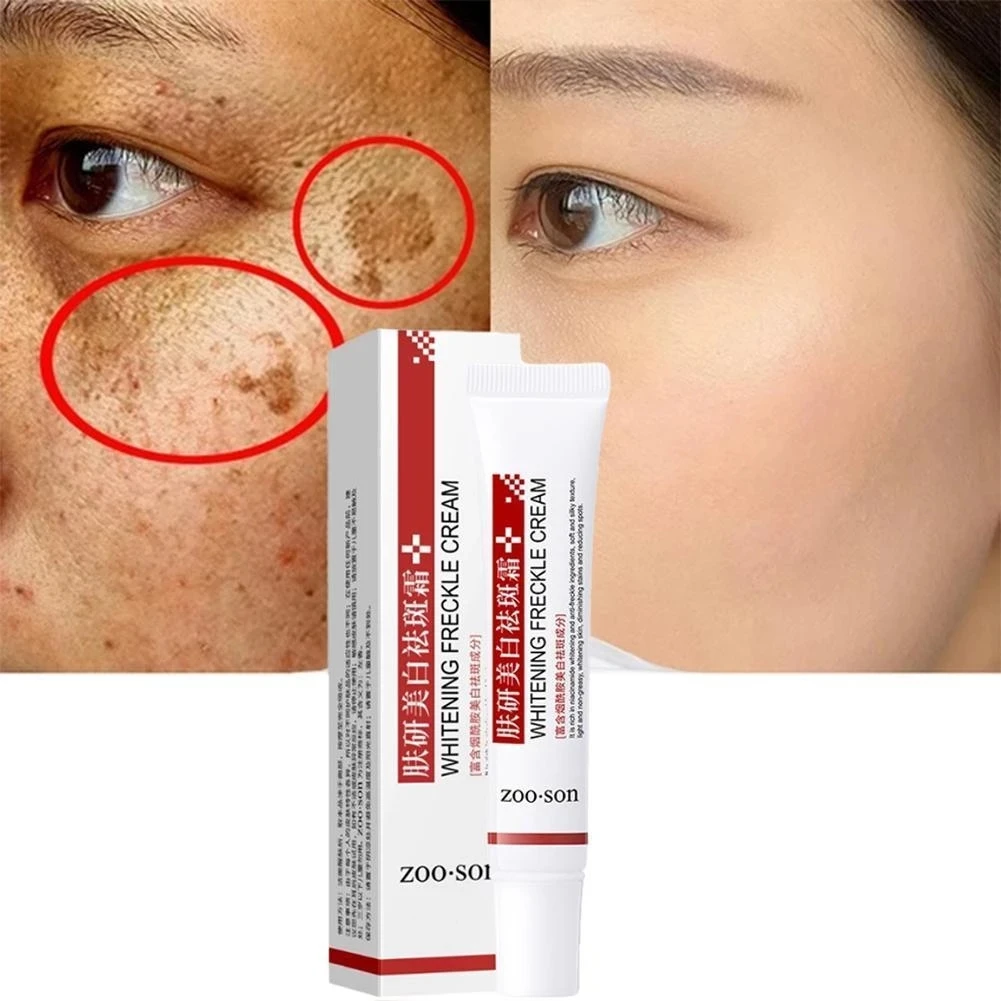 

20g Effective Whitening Freckle Cream Remove Melasma Dark Spots Niacinamide Melanin Corrector Brighten Skin Lightening Cream