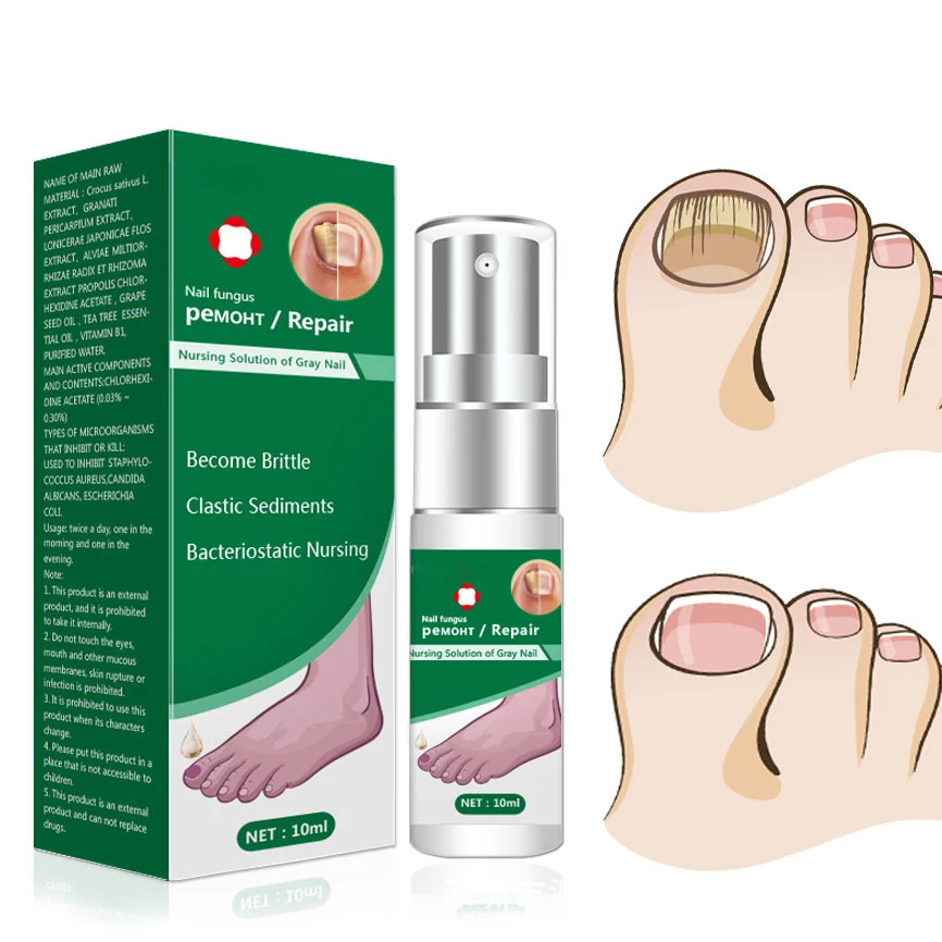 Nail Fungus Treatment Nails Foot Repair Toe Nail Fungal Removal Gel Anti Infection Paronychia Onychomycosis Feet Care Essence 1p
Nail Fungus Treatment Nails Foot Repair Toe Nail Fungal Removal Gel Anti Infection Paronychia Onychomycosis Feet Care Essence 1p