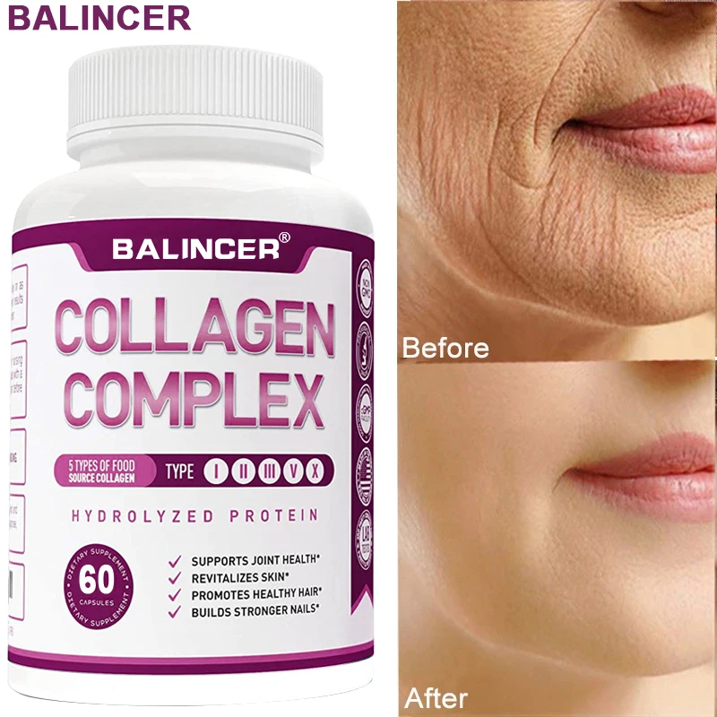 Supports Joint Health,Skin Radiance,Elasticity and Hydration,Keeps Skin Radiant,Promotes Strong Hair,Antioxidant,Anti-Aging
Supports Joint Health,Skin Radiance,Elasticity and Hydration,Keeps Skin Radiant,Promotes Strong Hair,Antioxidant,Anti-Aging