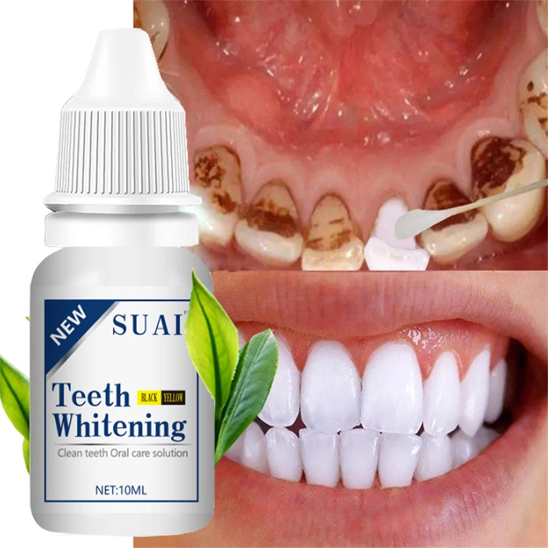 

SUAI Teeth Whitening Essence Liqud Oral Cleansing Products Remove Oral Odor Plaque Stains Serum Fresh Breath Dental Bleach Tools