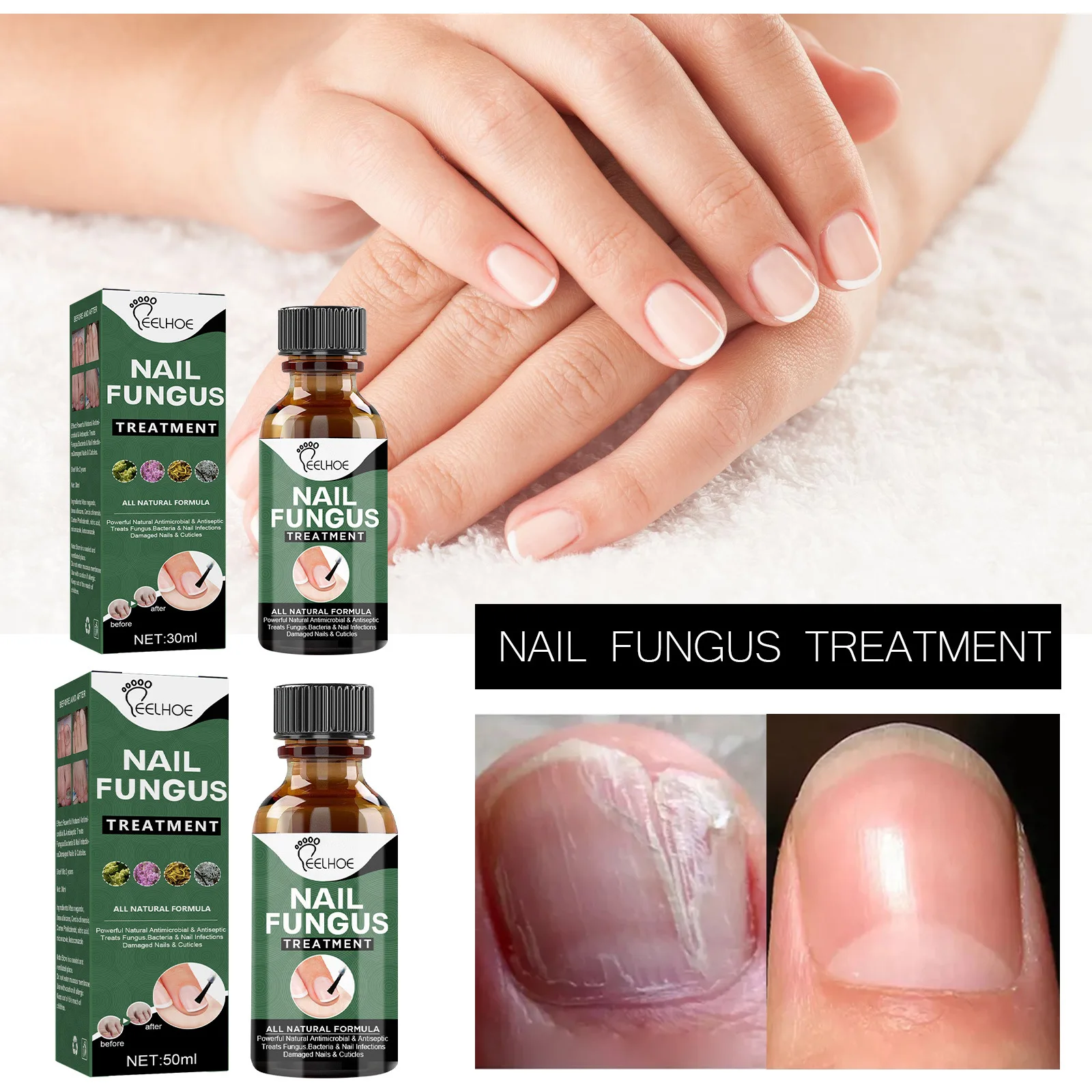 50ml Toenail Nail Treatments Repair Essence Feet Care Serum Nail Fungus Foot Toe Fungal Removal Gel Anti Infection Onychomycosis
50ml Toenail Nail Treatments Repair Essence Feet Care Serum Nail Fungus Foot Toe Fungal Removal Gel Anti Infection Onychomycosis