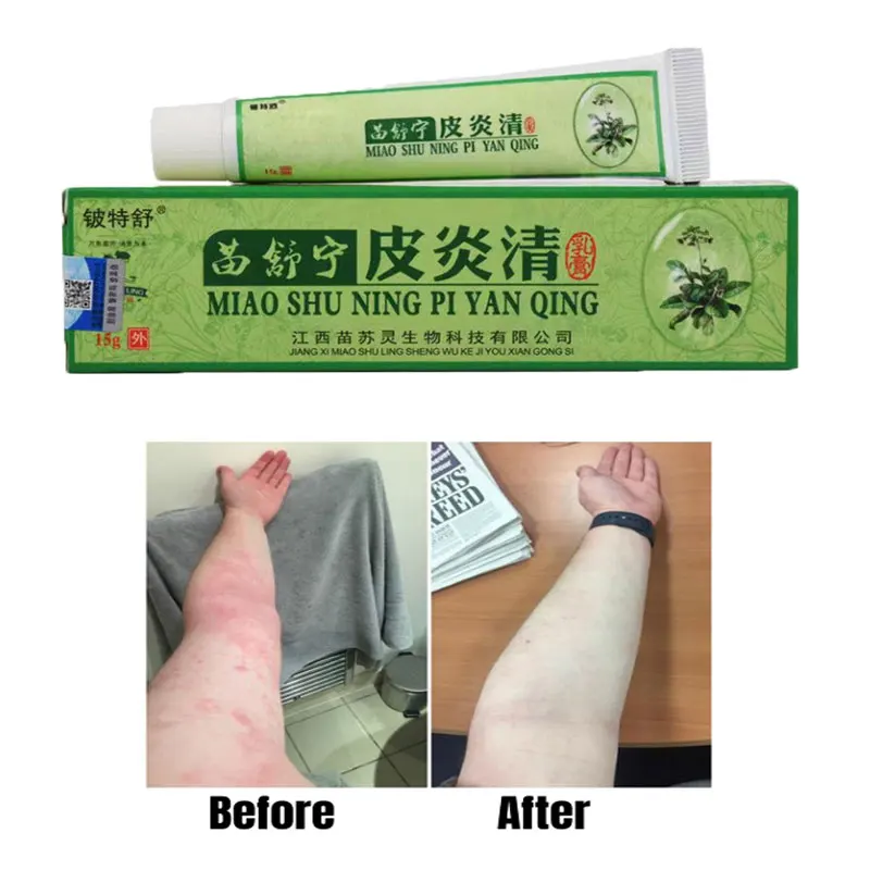 Dry Crack Feet Anti Cracking Repair Cream Dermatitis Eczematoid Eczema Ointment Atopic DermatiTis Cream Psoriasis Ointment
Dry Crack Feet Anti Cracking Repair Cream Dermatitis Eczematoid Eczema Ointment Atopic DermatiTis Cream Psoriasis Ointment