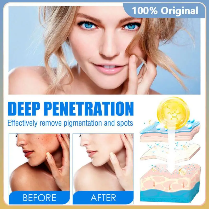 NEW Whitening Face Cream 20% Vitamin C Repairs Lightens Freckles Removes Black Spots Melanin Brightens Face Cream
NEW Whitening Face Cream 20% Vitamin C Repairs Lightens Freckles Removes Black Spots Melanin Brightens Face Cream