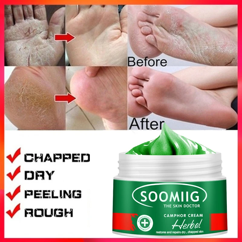 Антибликовый бальзам, китайская травяная восстанавливающая мазь для удаления огрубевшей кожи, увлажняющая
Антибликовый бальзам, китайская травяная восстанавливающая мазь для удаления огрубевшей кожи, увлажняющая