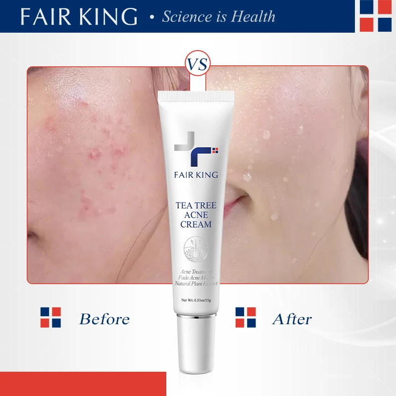 FAIRKING Tea Tree AcneCream Fade Pimples Skin CareScars Repair Removal Pore Shrinking Control Moisturizing Smoothing Skin Care
FAIRKING Tea Tree AcneCream Fade Pimples Skin CareScars Repair Removal Pore Shrinking Control Moisturizing Smoothing Skin Care