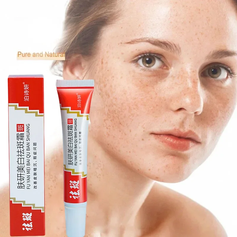 Freckle Whitening Cream Black Dots Melasma Remover Anti Brown Stain Lighten Pigmentation Moisturizing Korean Skin Care Products 
Freckle Whitening Cream Black Dots Melasma Remover Anti Brown Stain Lighten Pigmentation Moisturizing Korean Skin Care Products