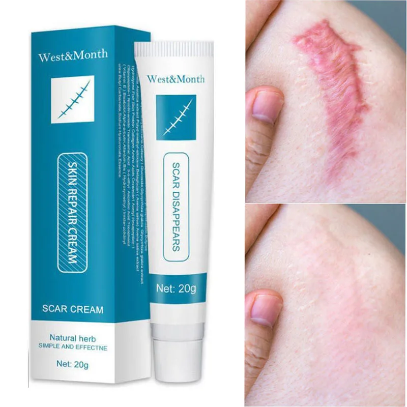 Herbal Scar Removal Cream Gel Stretch Marks Remove Acne Spots Burn Surgical Treatment Smooth Whitening Face Body Skin Care
Herbal Scar Removal Cream Gel Stretch Marks Remove Acne Spots Burn Surgical Treatment Smooth Whitening Face Body Skin Care