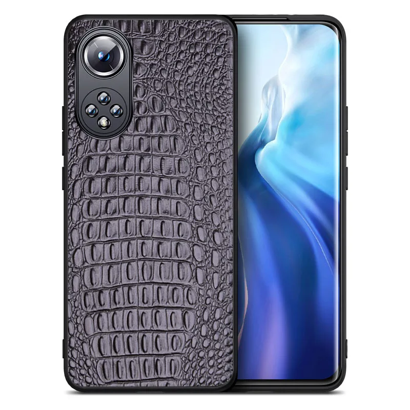 Hot Sale Luxury Genuine Cow Crocodil Leather Magnetic Cover Mobile Phone Book Case For Huawei Nova 9 Nova9 Pro Phone Cases Funda
Hot Sale Luxury Genuine Cow Crocodil Leather Magnetic Cover Mobile Phone Book Case For Huawei Nova 9 Nova9 Pro Phone Cases Funda
