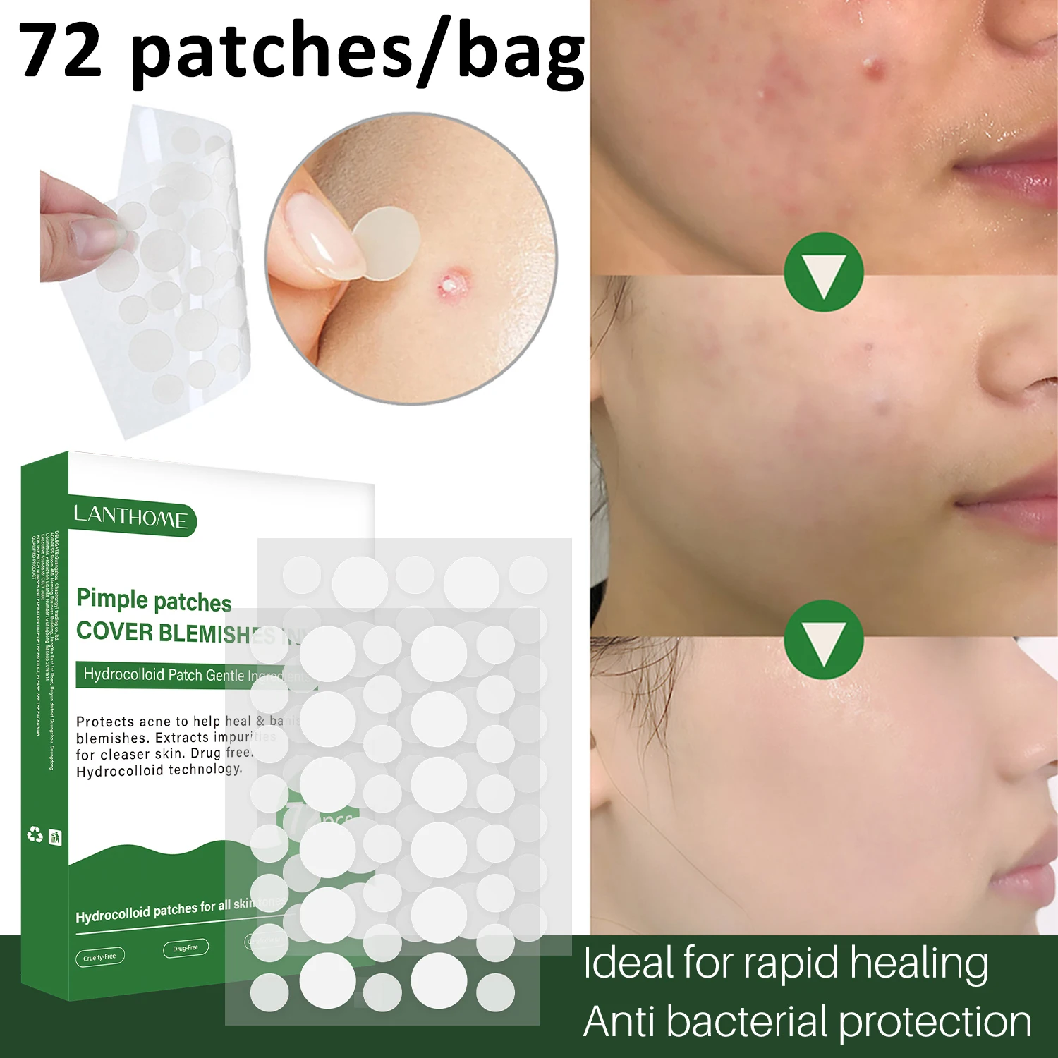 72 patches/bag Acne Pimple Patch Stickers Waterproof Acne Treatment Pimple Remover Tool Blemish Spot Facial Mask Skin Care
72 patches/bag Acne Pimple Patch Stickers Waterproof Acne Treatment Pimple Remover Tool Blemish Spot Facial Mask Skin Care