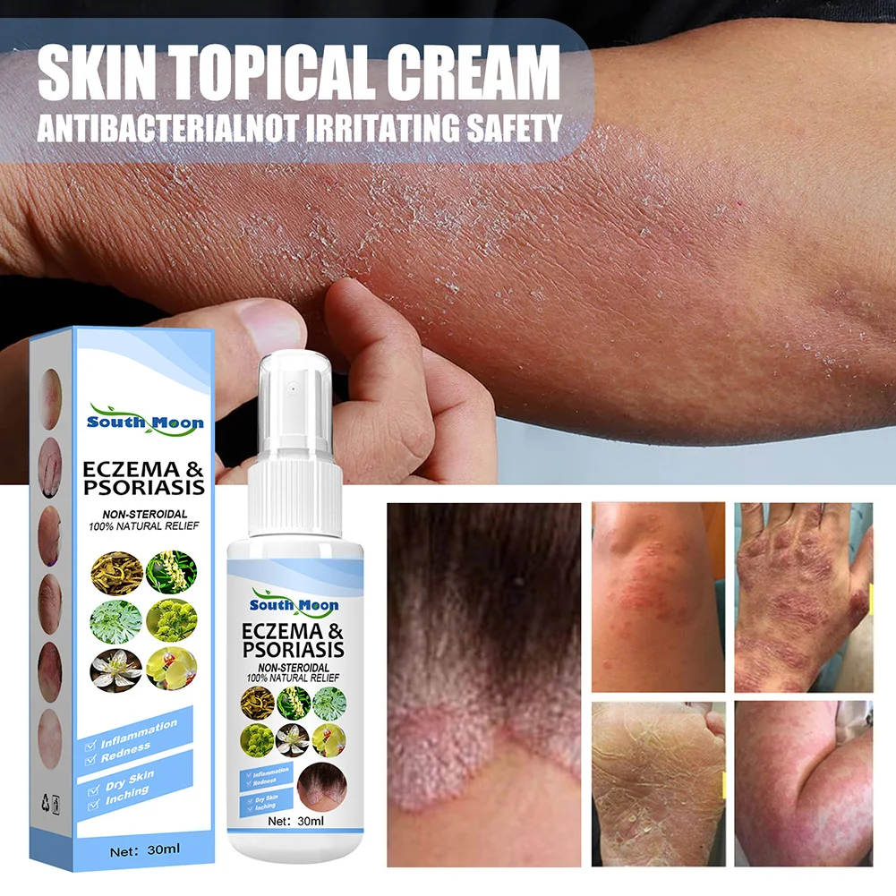 Skin Psoriasis Spray Herb Essence Dermatitis Eczematoid Eczema Ointment Treatment Psoriasis Skin Care Antibacterial Spray 30ml
Skin Psoriasis Spray Herb Essence Dermatitis Eczematoid Eczema Ointment Treatment Psoriasis Skin Care Antibacterial Spray 30ml