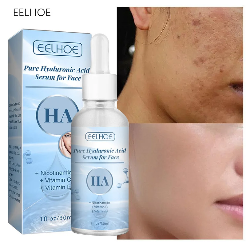 Hyaluronic Acid Moisturizing Face Serum Niacinamide Fade Dark Spot Anti-wrinkle Skin Care Whiten Remove Freckles Beauty Products
Hyaluronic Acid Moisturizing Face Serum Niacinamide Fade Dark Spot Anti-wrinkle Skin Care Whiten Remove Freckles Beauty Products