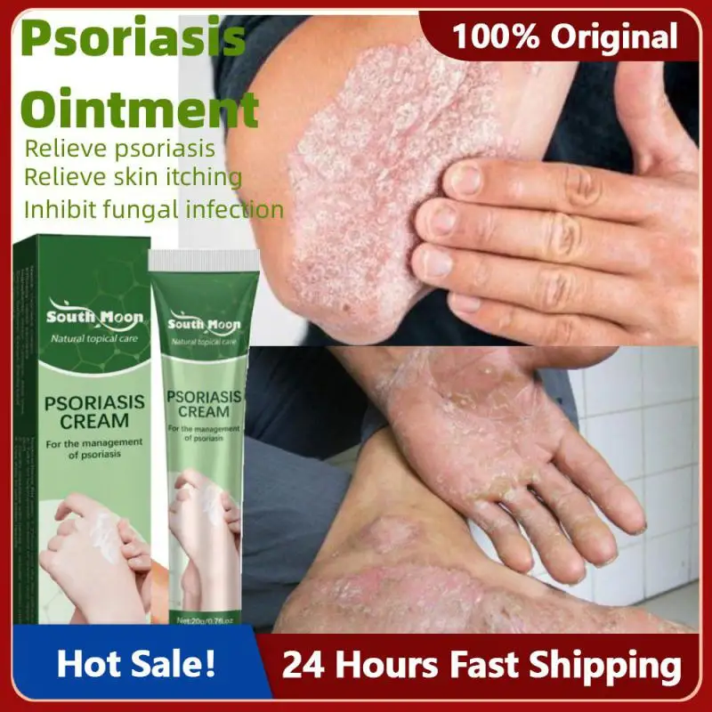 Psoriasis Cream Eczema Ointment Psoriasis Treatment Hand Tinea Foot Odor Versicolor Inhibit Dermatitis Fungus Anti-itch Cream
Psoriasis Cream Eczema Ointment Psoriasis Treatment Hand Tinea Foot Odor Versicolor Inhibit Dermatitis Fungus Anti-itch Cream