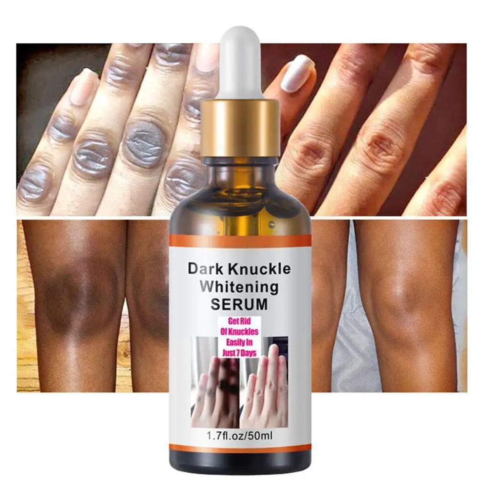 50ml Dark Knockle Whitening Serum Moisturzing Hand Non-greasy Lightening Oil Skin To Glow Cream Whitening Skin Care Anti-ag V1r6
50ml Dark Knockle Whitening Serum Moisturzing Hand Non-greasy Lightening Oil Skin To Glow Cream Whitening Skin Care Anti-ag V1r6