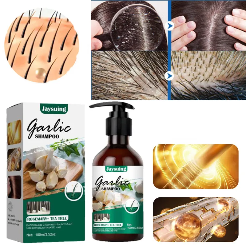 

100ML Garlic Therapeutic Shampoo Anti-Dandruff Treatment Itching professional Growth prevention hair Loss Nourishing Shampoo