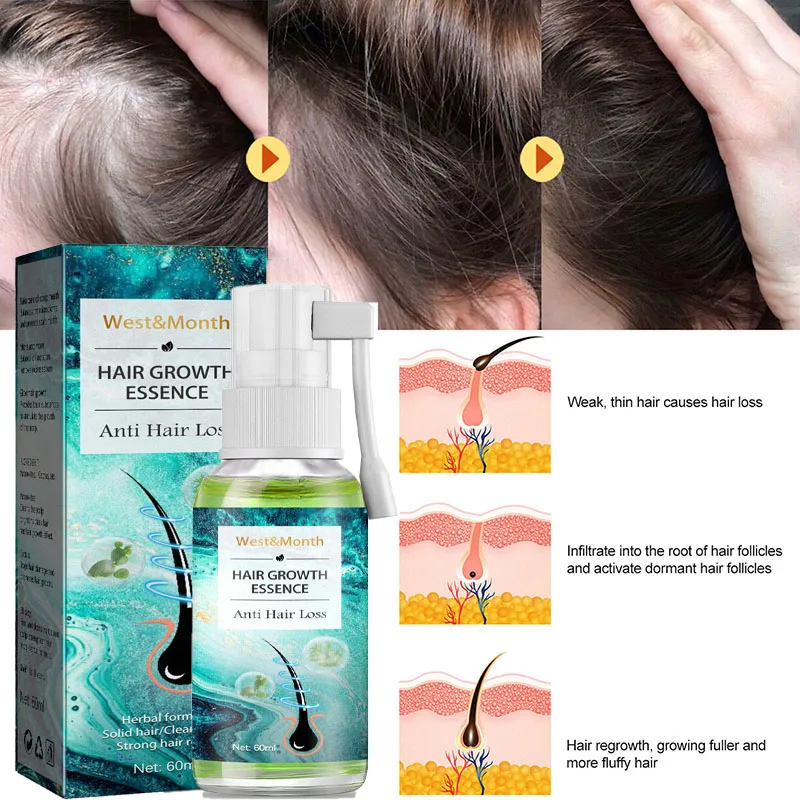 Hair Growth Products Anti Hair Loss Spray Serum Fast Growing Hair Essential Oil Scalp Treatment Nourish Damaged Hair Care 60ml
Hair Growth Products Anti Hair Loss Spray Serum Fast Growing Hair Essential Oil Scalp Treatment Nourish Damaged Hair Care 60ml