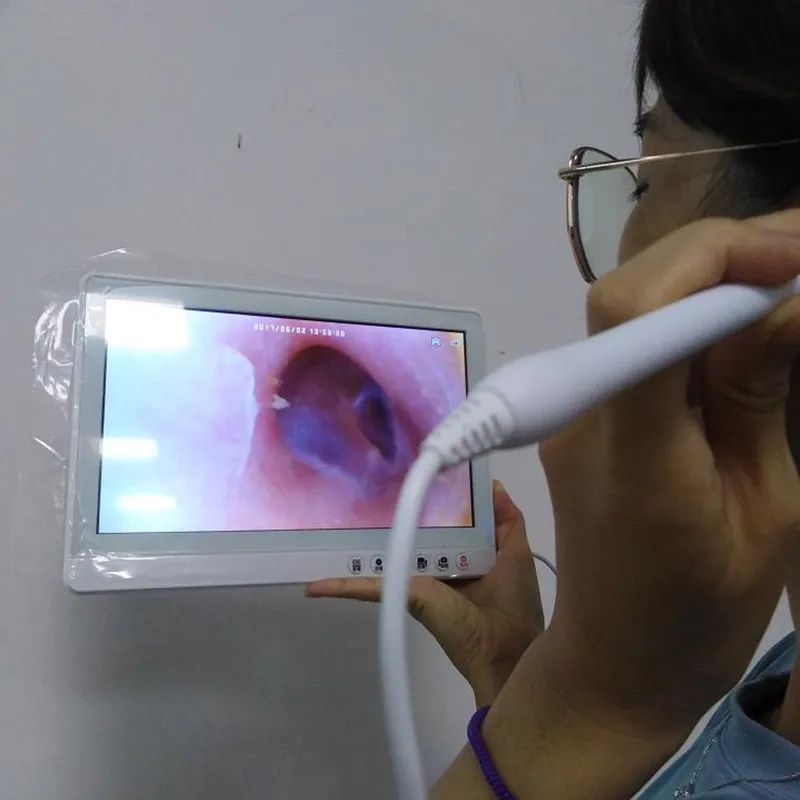 Видео Otoscope для домашних животных с 10,1-дюймовым экраном Usb Endosocpe камера
Видео Otoscope для домашних животных с 10,1-дюймовым экраном Usb Endosocpe камера