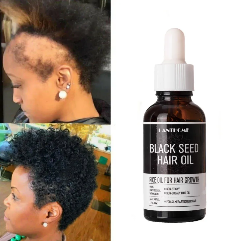 30ML Black Rice Hair Serum Essential Oil Anti-hair Loss Dry Hair Serum Conditioner Black Seed Hair Oil Hair Growth Health Care
30ML Black Rice Hair Serum Essential Oil Anti-hair Loss Dry Hair Serum Conditioner Black Seed Hair Oil Hair Growth Health Care