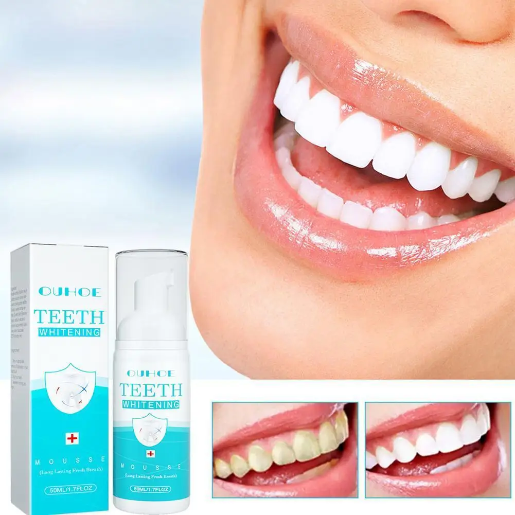50ml Ultra-Fine Mousse Foam Deep Cleansing Whitening Tooth Clean Breath Freshen New Teeth Dissolve Foam Whiten Toot And Sta G1I3
50ml Ultra-Fine Mousse Foam Deep Cleansing Whitening Tooth Clean Breath Freshen New Teeth Dissolve Foam Whiten Toot And Sta G1I3