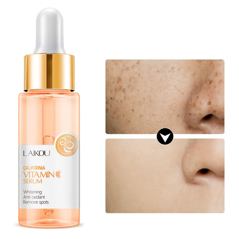 Vitamin C Serum Colagen Creme Clareador De Manchas Pele Gluthation Blanchissante Hyaluron Skin Tone Aceites Esenciales Original
Vitamin C Serum Colagen Creme Clareador De Manchas Pele Gluthation Blanchissante Hyaluron Skin Tone Aceites Esenciales Original