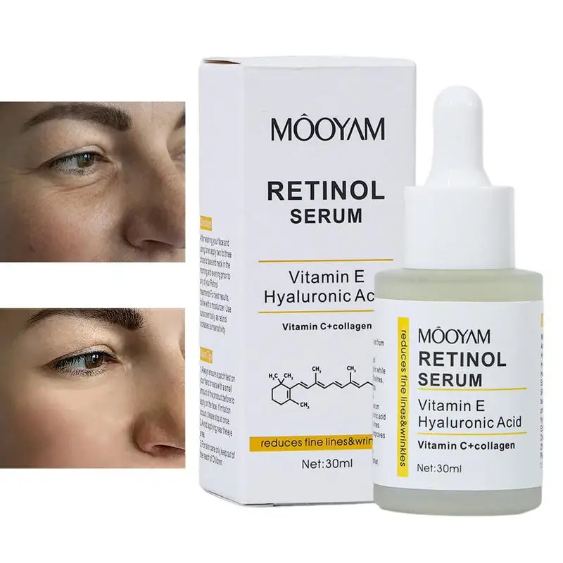 

Эссенция ретинола для лица, витамин E, гиалуроновая кислота, увлажняющий крем против старения, 30 мл, восстанавливающие сыворотки для сухой кожи, для тонких линий