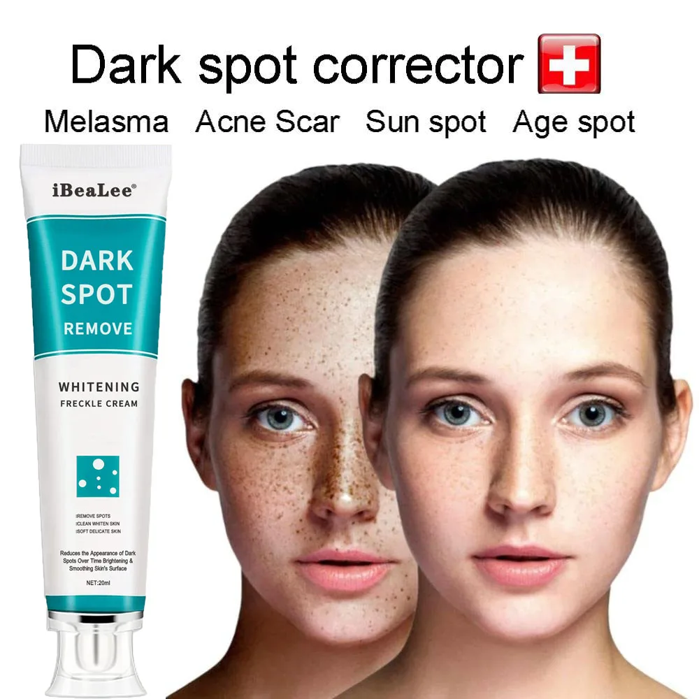 20ml Whitening Freckle Cream Remove Dark Spots Face Moisturizing Melasma Remover Creams Brightening Effective Repair Skin Care
20ml Whitening Freckle Cream Remove Dark Spots Face Moisturizing Melasma Remover Creams Brightening Effective Repair Skin Care