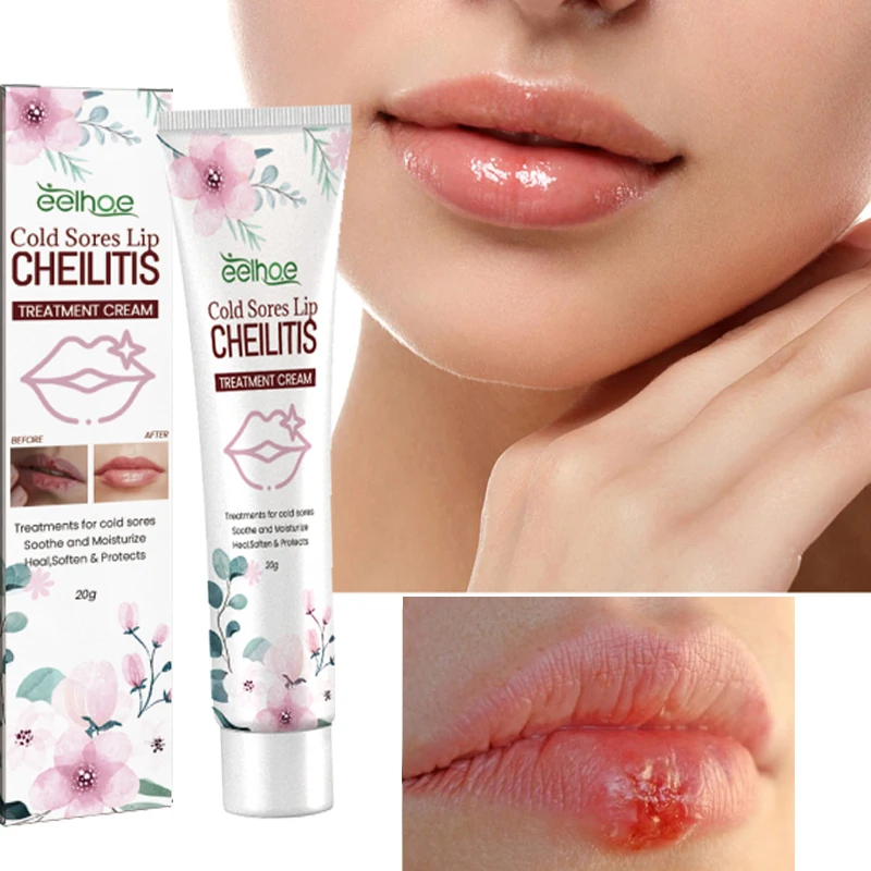 Sdotter Lip repair balm lightens lip lines Cold Sores Lip Cheilitis treatment cream lip particles anti-Cracking moisturizing car
Sdotter Lip repair balm lightens lip lines Cold Sores Lip Cheilitis treatment cream lip particles anti-Cracking moisturizing car