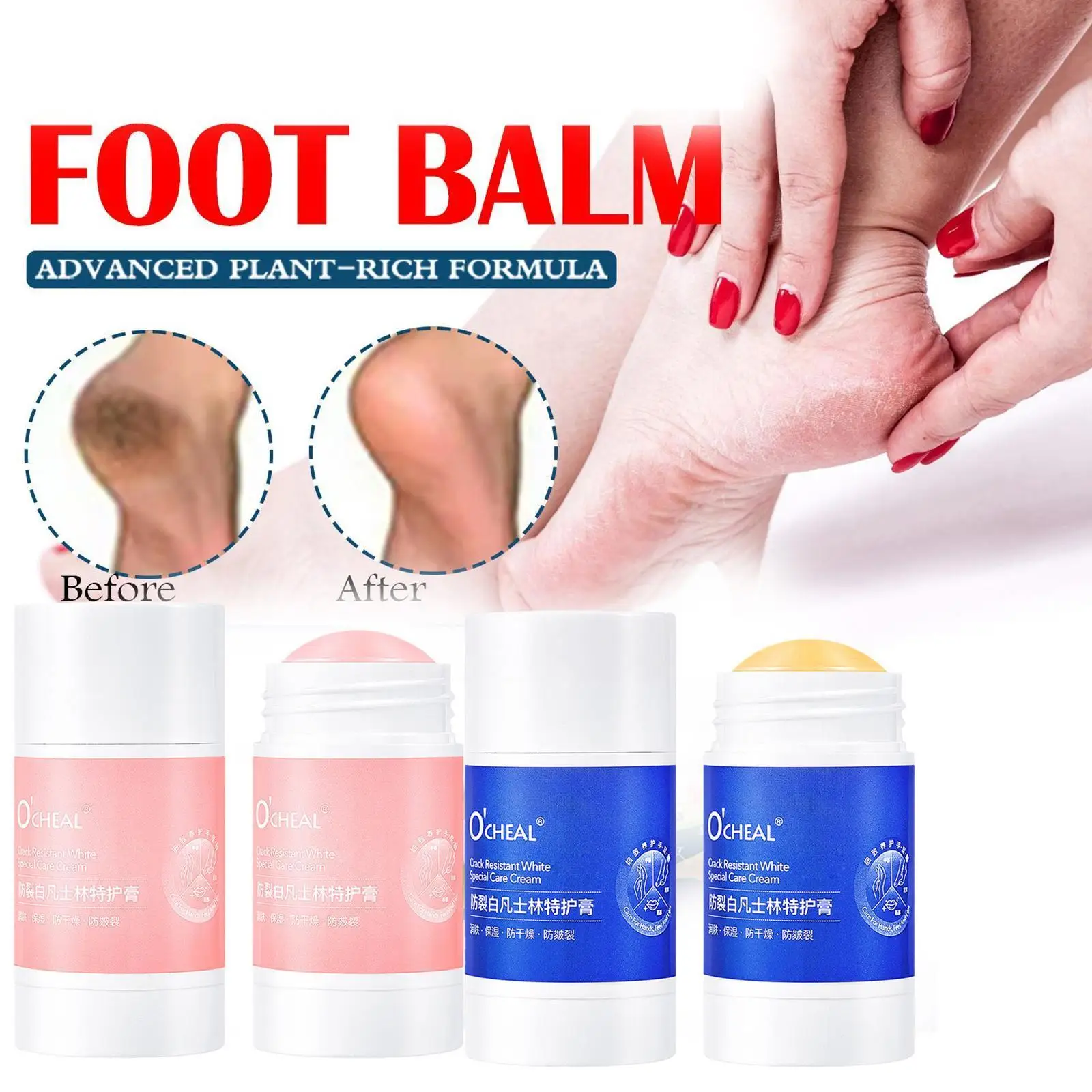 Anti-Drying Crack Foot Cream Hand Cracked Cream Anti Wholesale Cracking Dead Removal Skin Hand Care Feet Repair Cr I2N2
Anti-Drying Crack Foot Cream Hand Cracked Cream Anti Wholesale Cracking Dead Removal Skin Hand Care Feet Repair Cr I2N2