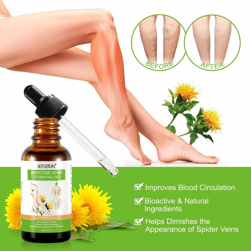 Leg Varicose Vein Repair Essential Oil Vein Varicose Red Blood Thread Leg care Cream Safflower Pain Slimming Weight Loss
Leg Varicose Vein Repair Essential Oil Vein Varicose Red Blood Thread Leg care Cream Safflower Pain Slimming Weight Loss