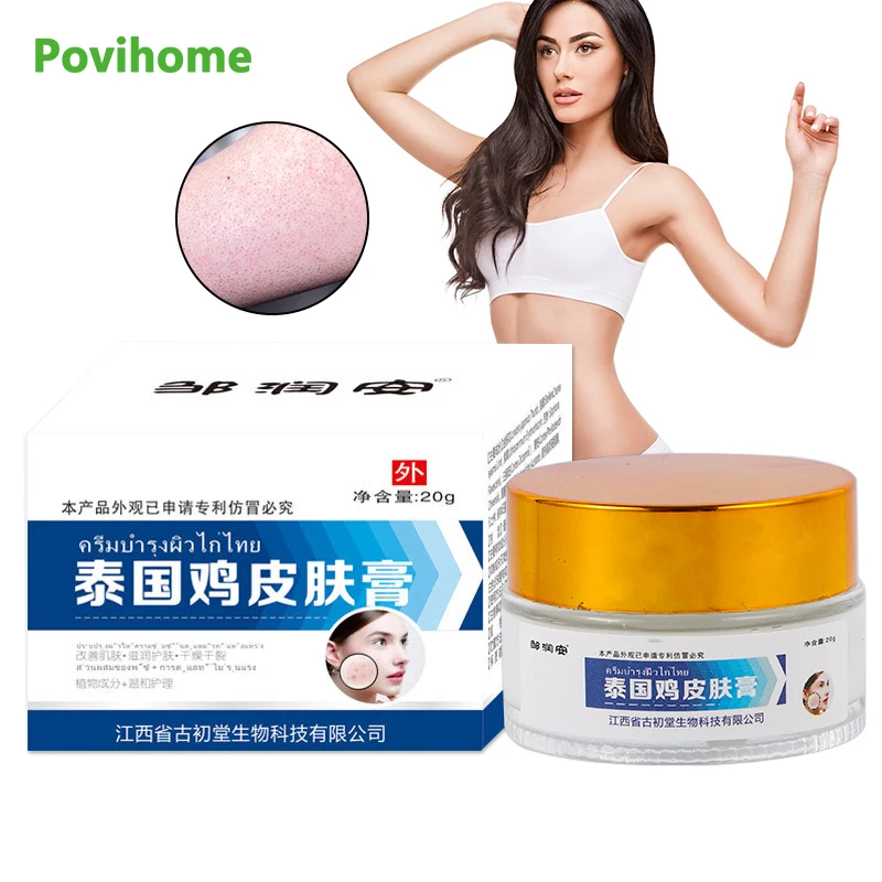 20G Remove Goosebumps Ointment Keratosis Follicularis Cream Soften Horny Dead Skin Removal Dry Rough Itching Relief Moisturizer
20G Remove Goosebumps Ointment Keratosis Follicularis Cream Soften Horny Dead Skin Removal Dry Rough Itching Relief Moisturizer