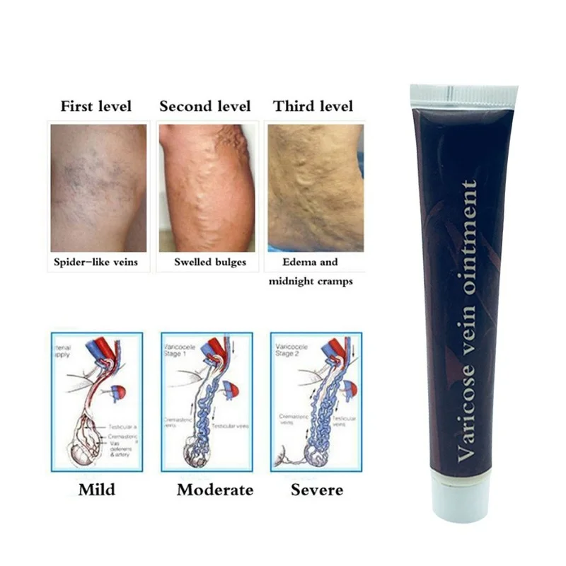 Natural Herbal Medicine for Treating Varicose Vascular Inflammation Massage Cream Cure Varicose Vein Ointment
Natural Herbal Medicine for Treating Varicose Vascular Inflammation Massage Cream Cure Varicose Vein Ointment