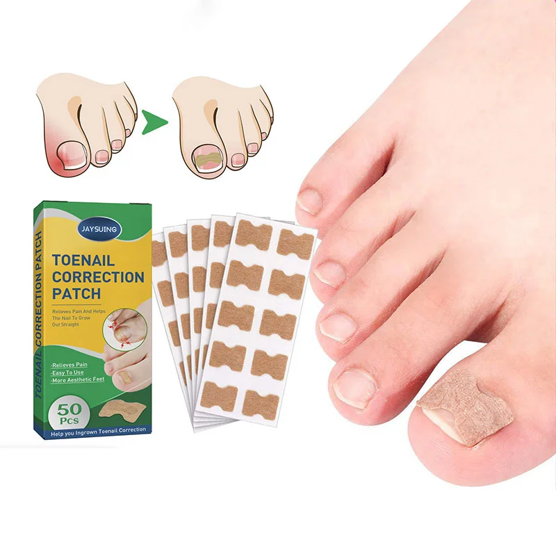 Nail Correction Stickers Ingrown Toenail Corrector Patches Waterproof Paronychia Treatment Recover Corrector Pedicure Tools
Nail Correction Stickers Ingrown Toenail Corrector Patches Waterproof Paronychia Treatment Recover Corrector Pedicure Tools