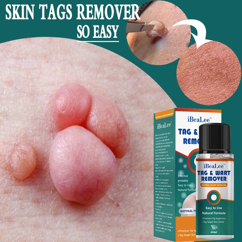 Skin Tag Remover Cream Painless Warts Mole Skin Dark Spot Remover Serum Freckle Face Wart Tag Treatment Removal Essential Oil
Skin Tag Remover Cream Painless Warts Mole Skin Dark Spot Remover Serum Freckle Face Wart Tag Treatment Removal Essential Oil