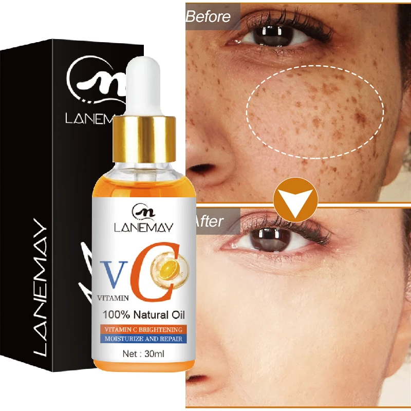 

Vitamin C Whitening Serum Remove Dark Spots Melanin Acne Mark Brighten Facial Serum Hyaluronic Acid Anti Aging Essence Skin Care
