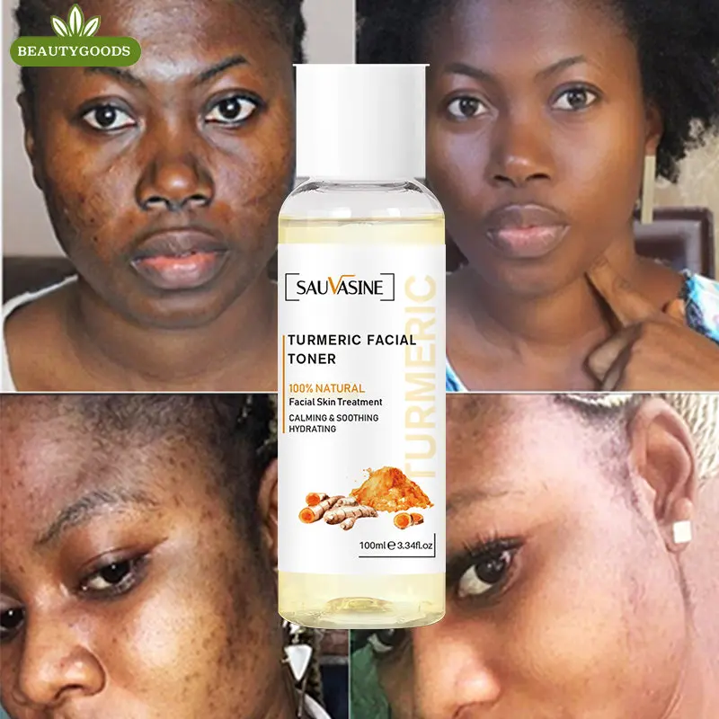 1 Pc Natural Tumeric Dark Spots Facial Toner,Eraser Spotless Skin, Even Tone, Flawless Body Care 100ml
1 Pc Natural Tumeric Dark Spots Facial Toner,Eraser Spotless Skin, Even Tone, Flawless Body Care 100ml