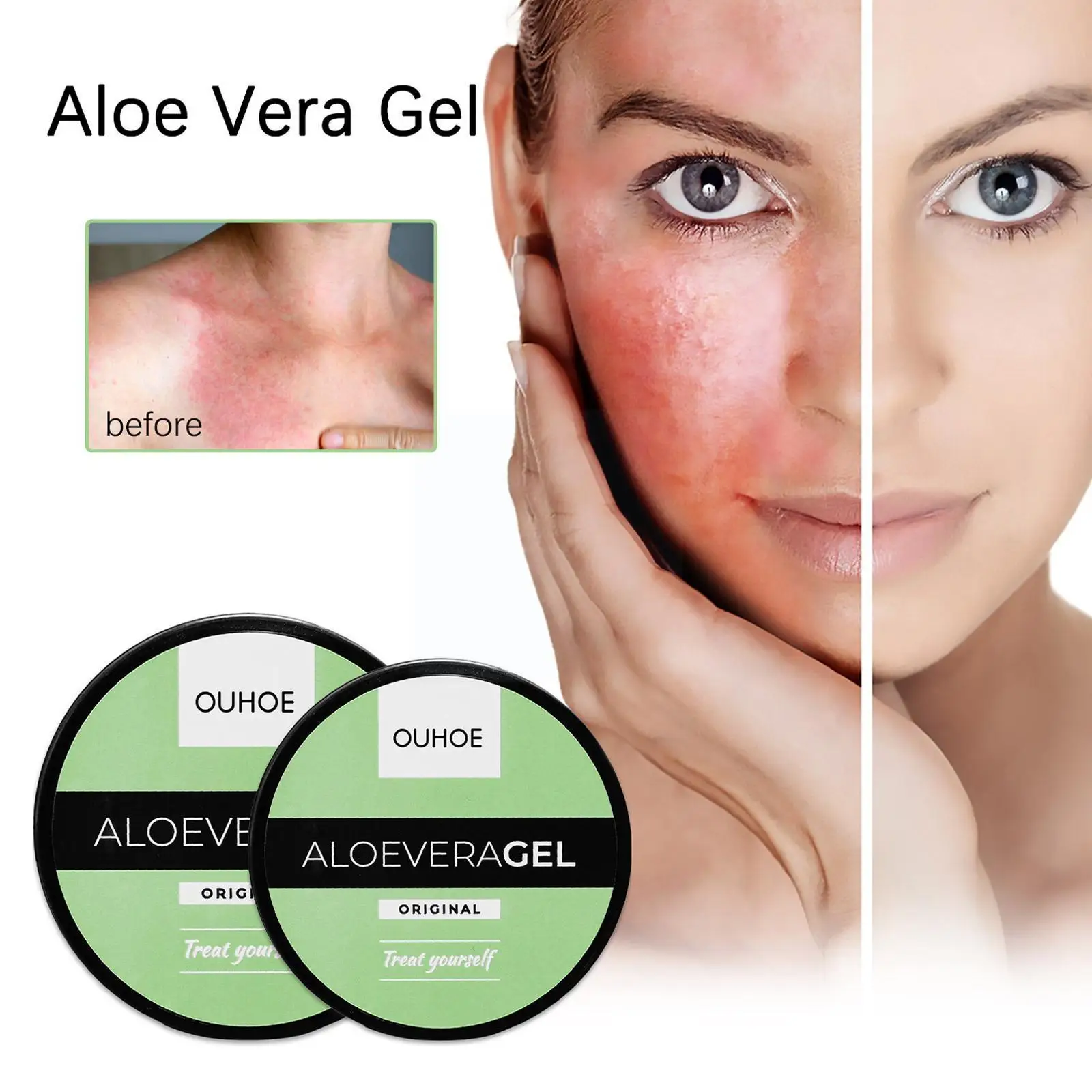 Aloe Vera Gel Skin Care Supplementary Nutrition Moisturizing Acne Fine Sun Pores Whitening After Skin The Dilute Repair Bea Y5J9
Aloe Vera Gel Skin Care Supplementary Nutrition Moisturizing Acne Fine Sun Pores Whitening After Skin The Dilute Repair Bea Y5J9
