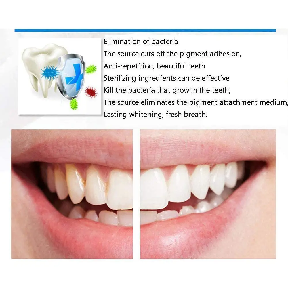 Dentist Teeth Whitening 44% Peroxide Dental Bleaching Kit Sticker Dental System Whitener Tools Tooth R4b4
Dentist Teeth Whitening 44% Peroxide Dental Bleaching Kit Sticker Dental System Whitener Tools Tooth R4b4