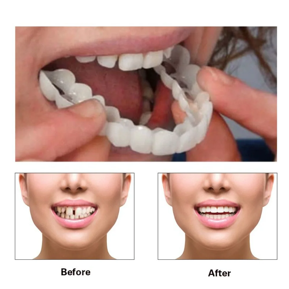 Perfect Fit Teeth Whitening Fake Tooth Cover Snap On Silicone Smile Veneers Teeth Upper Beauty Tool Cosmetic Teeth Free shipping 
Perfect Fit Teeth Whitening Fake Tooth Cover Snap On Silicone Smile Veneers Teeth Upper Beauty Tool Cosmetic Teeth Free shipping