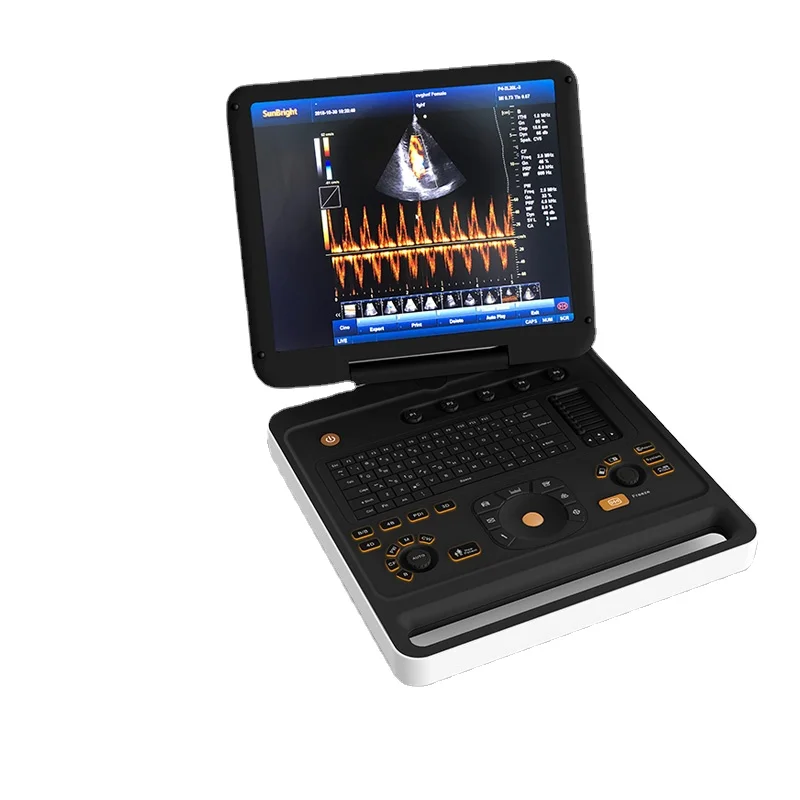 Best price Mindray ultrasound M5 ultrasound machine/Hand-carried Portable 3D 4D Color Ultrasound Doppler for hospital
Best price Mindray ultrasound M5 ultrasound machine/Hand-carried Portable 3D 4D Color Ultrasound Doppler for hospital