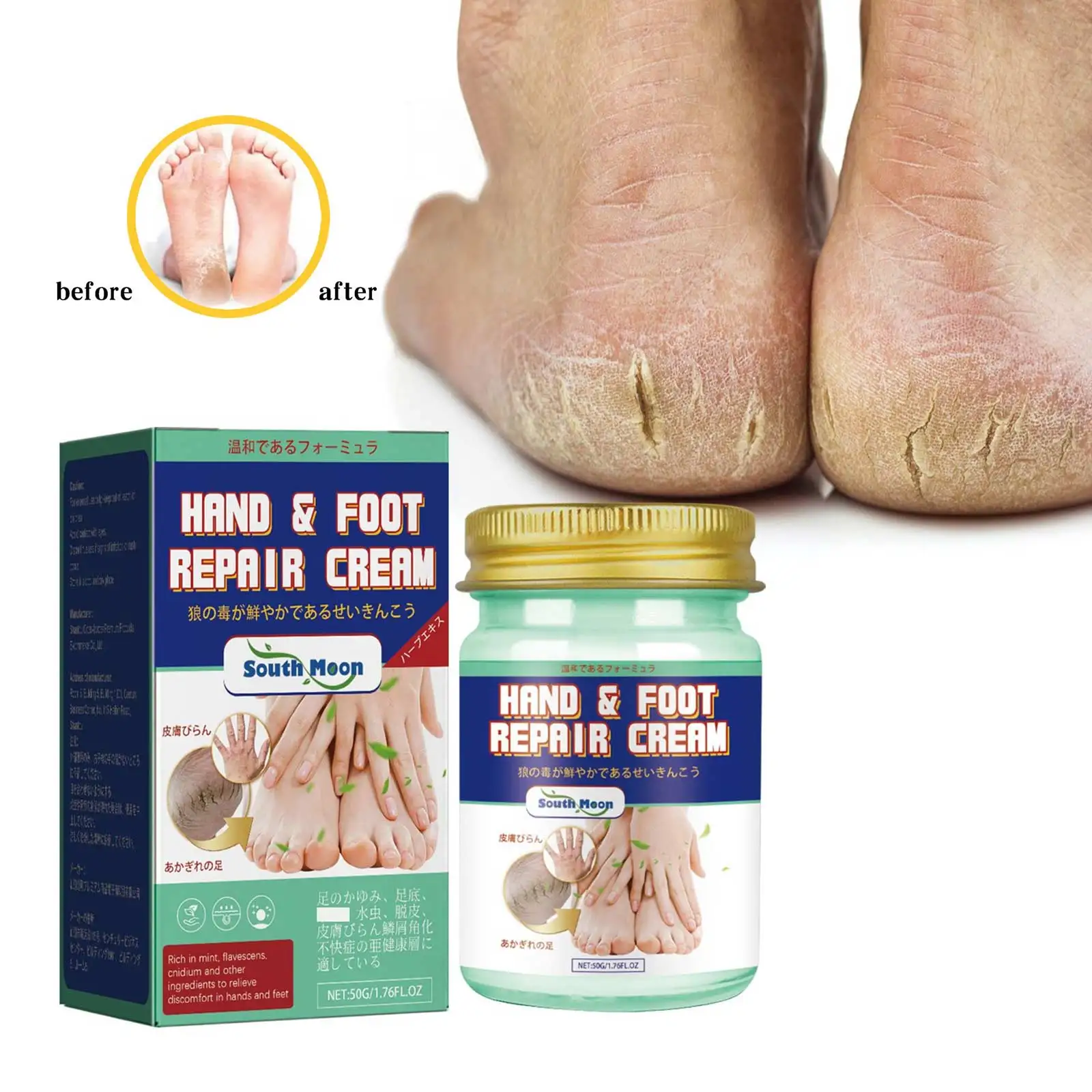 Feet Repair Cream Heel Cracked Repair Treatment Anti Dryness Chapping Relieve Rough Skin Remove Dead Skin Foot Peeling Ointment
Feet Repair Cream Heel Cracked Repair Treatment Anti Dryness Chapping Relieve Rough Skin Remove Dead Skin Foot Peeling Ointment