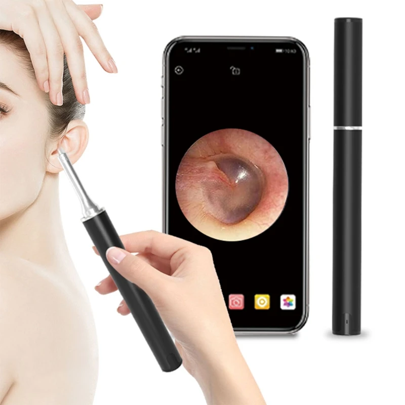 Earwax Removal Tool with Camera Earwax Cleaner Tools with 300W H D Wireless Ear Otoscope Earwax Cleaner Pick Kit M4YD
Earwax Removal Tool with Camera Earwax Cleaner Tools with 300W H D Wireless Ear Otoscope Earwax Cleaner Pick Kit M4YD