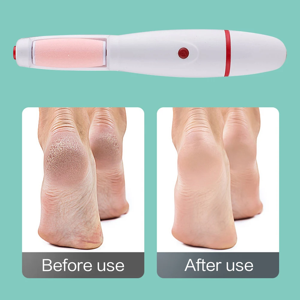 Electric Foot File Grinder USB Rechargeable Callus Dead Skin Remover Foot Heels Grinding Pedicure Tools
Electric Foot File Grinder USB Rechargeable Callus Dead Skin Remover Foot Heels Grinding Pedicure Tools
