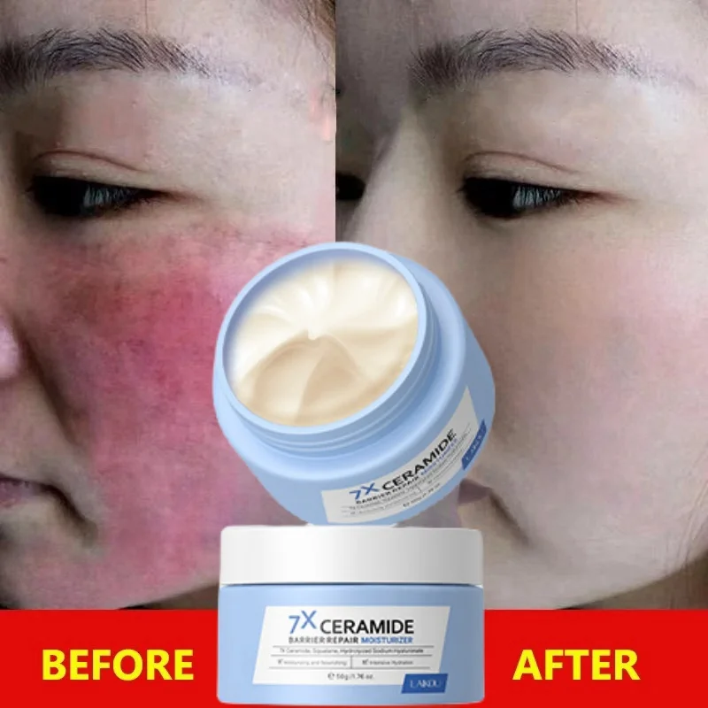 Higher Quality Facial Redness Repair Cream Rosacea Treat Sensitive Skin Dryness Moisturizer Hydrate Sooth Lotion Korean Cosmetic
Higher Quality Facial Redness Repair Cream Rosacea Treat Sensitive Skin Dryness Moisturizer Hydrate Sooth Lotion Korean Cosmetic