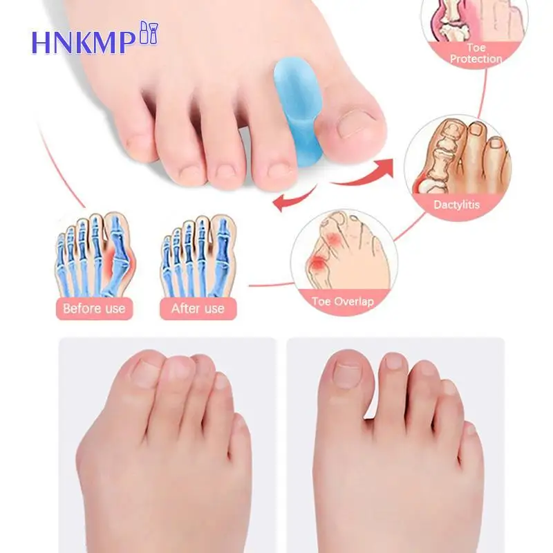 1 Pair Children Adult Silicone Gel Toe Separators Orthotics Bunion Separators Toe Stretchers Foot Care
1 Pair Children Adult Silicone Gel Toe Separators Orthotics Bunion Separators Toe Stretchers Foot Care