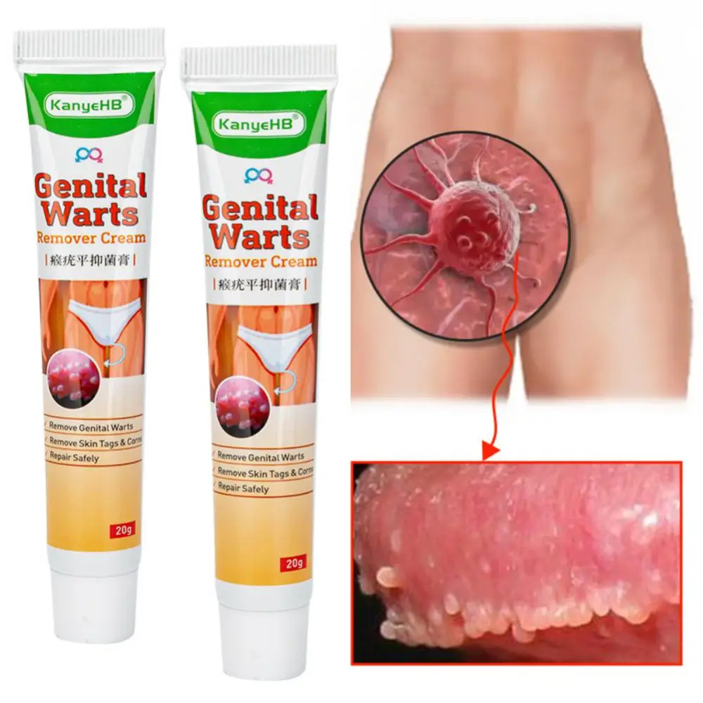 20g Genital Wart Herpes Remover Ointment Skin Tags Mole & Papillomas Wart Remover Condyloma Acuminatum Treatment Cream
20g Genital Wart Herpes Remover Ointment Skin Tags Mole & Papillomas Wart Remover Condyloma Acuminatum Treatment Cream