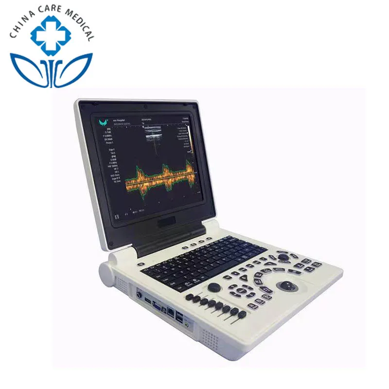 China cheapest medical portable black and white b ultrasound scanner/scanner/pregnancy machine price with probe
China cheapest medical portable black and white b ultrasound scanner/scanner/pregnancy machine price with probe