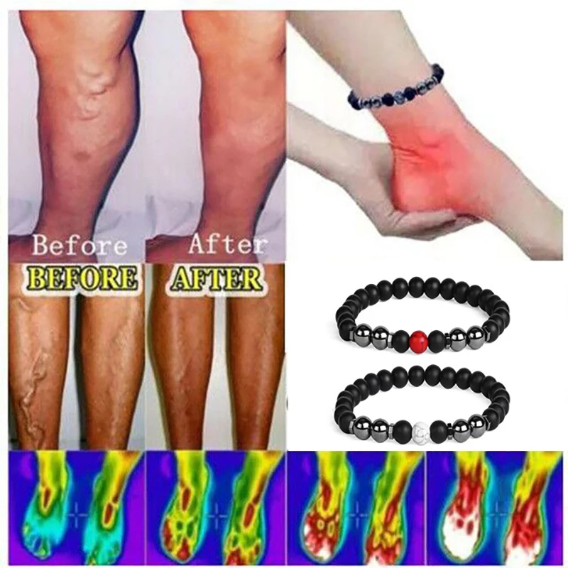 14 Style New Magnetic Hematite Anklet Men Weight Loss Non Magnetic Therapy Healing Balance Beads Reiki Yoga Bracelet For Women
14 Style New Magnetic Hematite Anklet Men Weight Loss Non Magnetic Therapy Healing Balance Beads Reiki Yoga Bracelet For Women