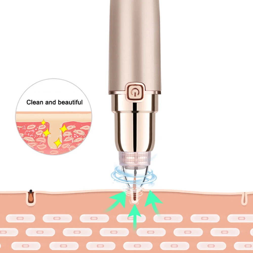 Мини-поры акне прибор для удаления черных точек вакуумный экстрактор поры