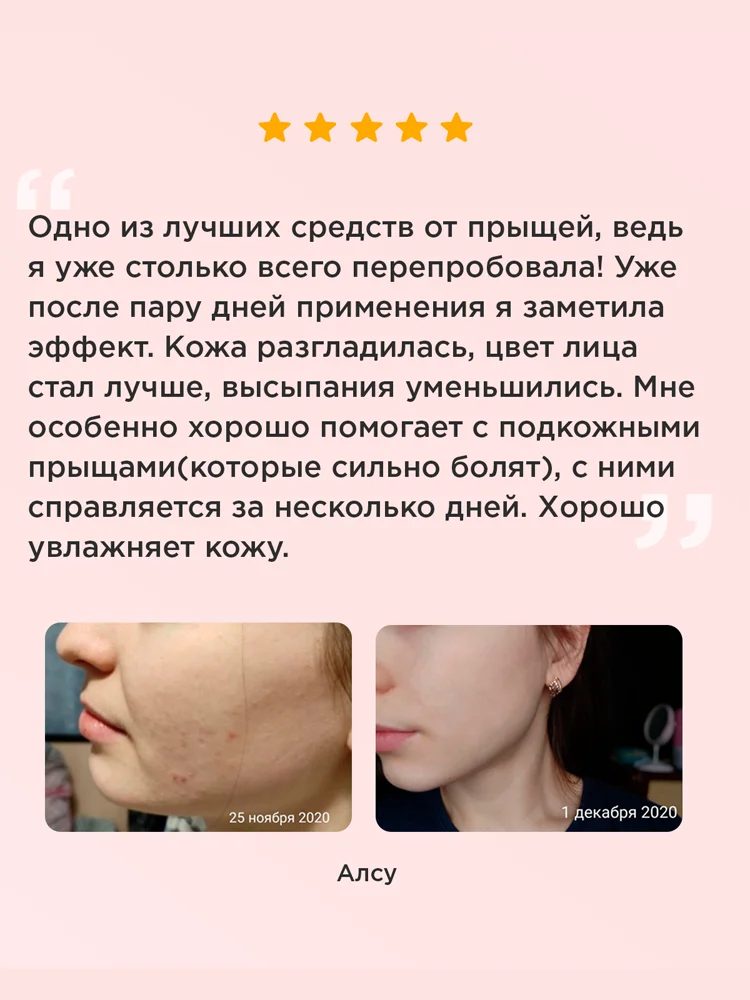 Сыворотка для лица ниацинамид косметика от прыщей черных точек пилинг уход за