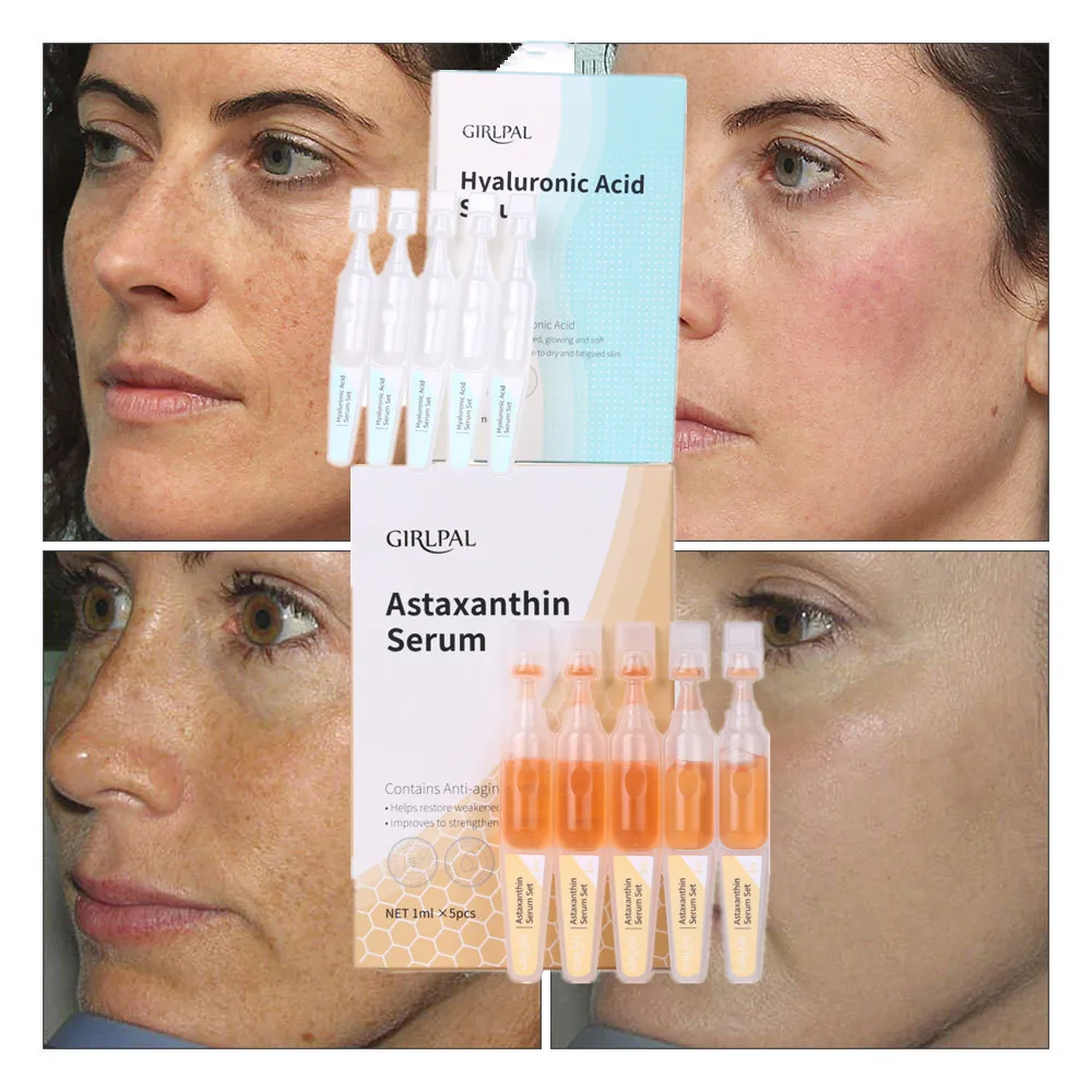 

Hyaluronic Acid Astaxanthin Freckle Whitening Brighten Face Serum Moisturizing Anti-wrinkle Shrink Pore Skin Care Products 5pcs