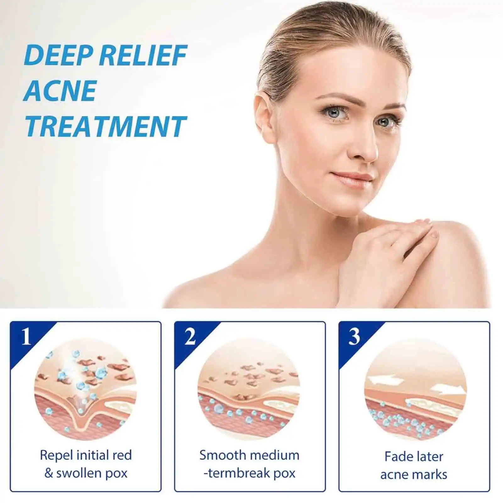 Отбеливающий крем для лица и удаления веснушек 20 г - Увлажняет борется с акне